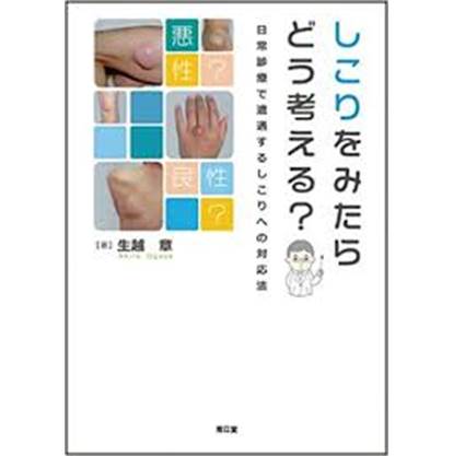 しこりをみたらどう考えるの書評